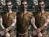 A male Dunmer, before and after becoming a vampire